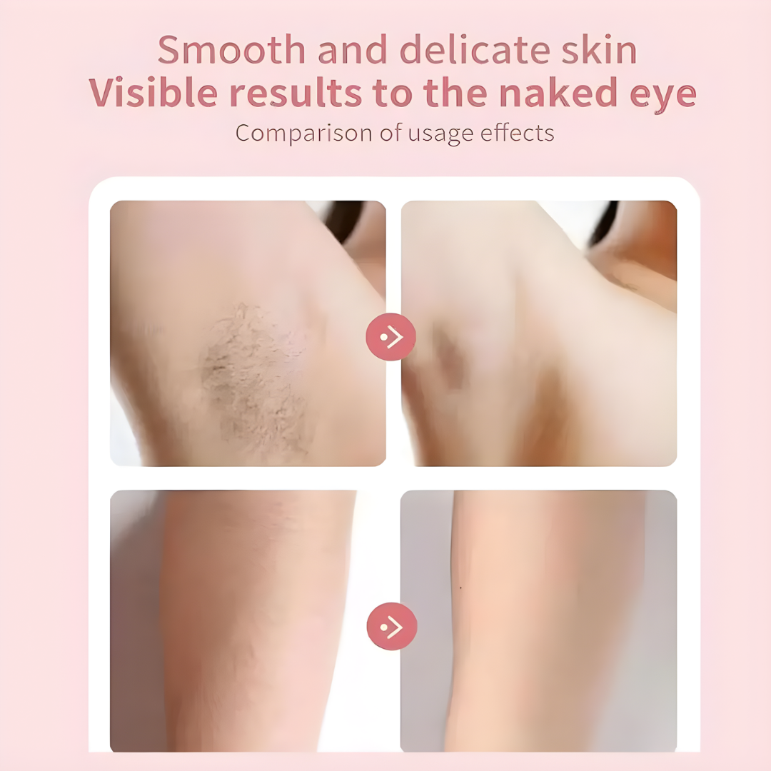 HairRemover: Uppladdningsbar Epilator Smärtfri Elektrisk Hår Borttagning Enhet