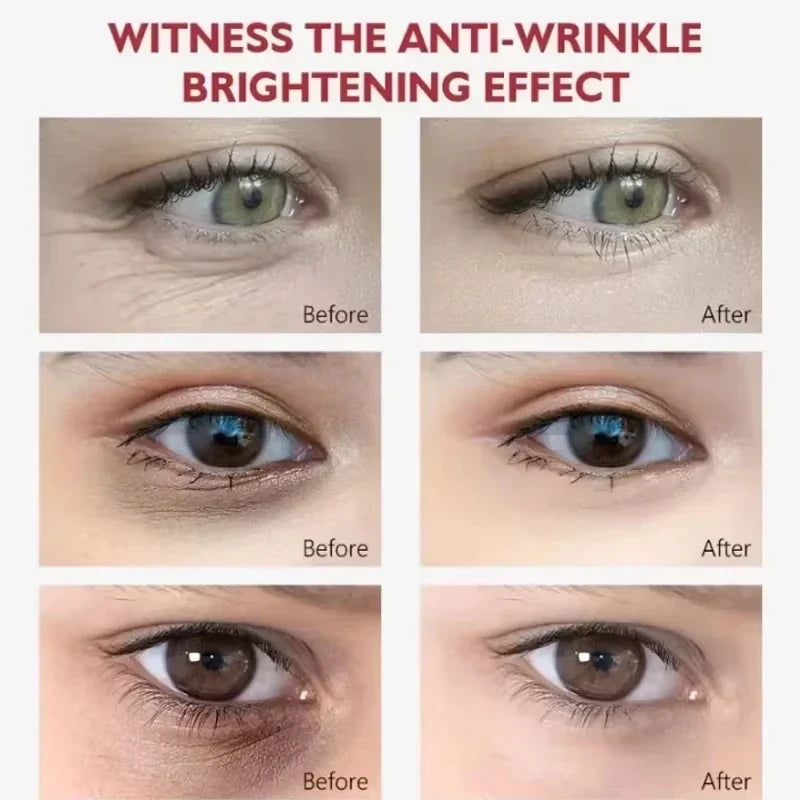 EyeCream 1+1 GRATIS: Hydraterande Uppstramande Anti Mörk Cirklar Öga Grädde Serum