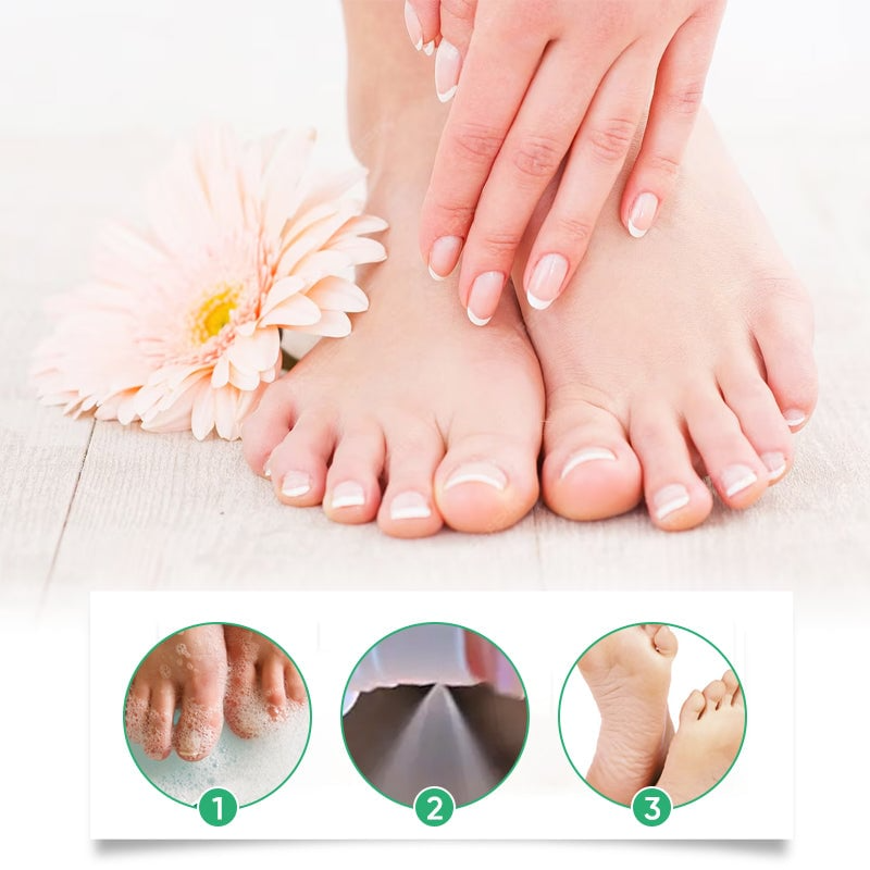 FootCare 1+1 GRATIS: Antimikrobiell Djup Återfuktning Fotvård Spray