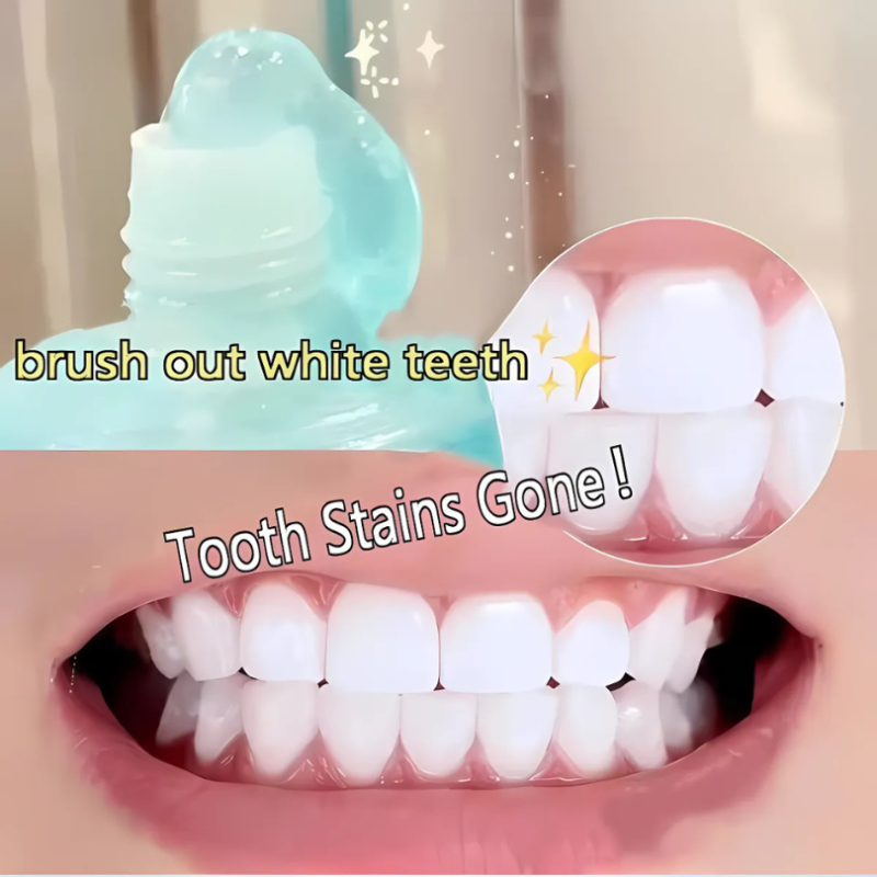 WhiteningToothpaste 1+1 GRATIS: Niacinamid Vitgörande Och Fläckborttagande Tandkräm