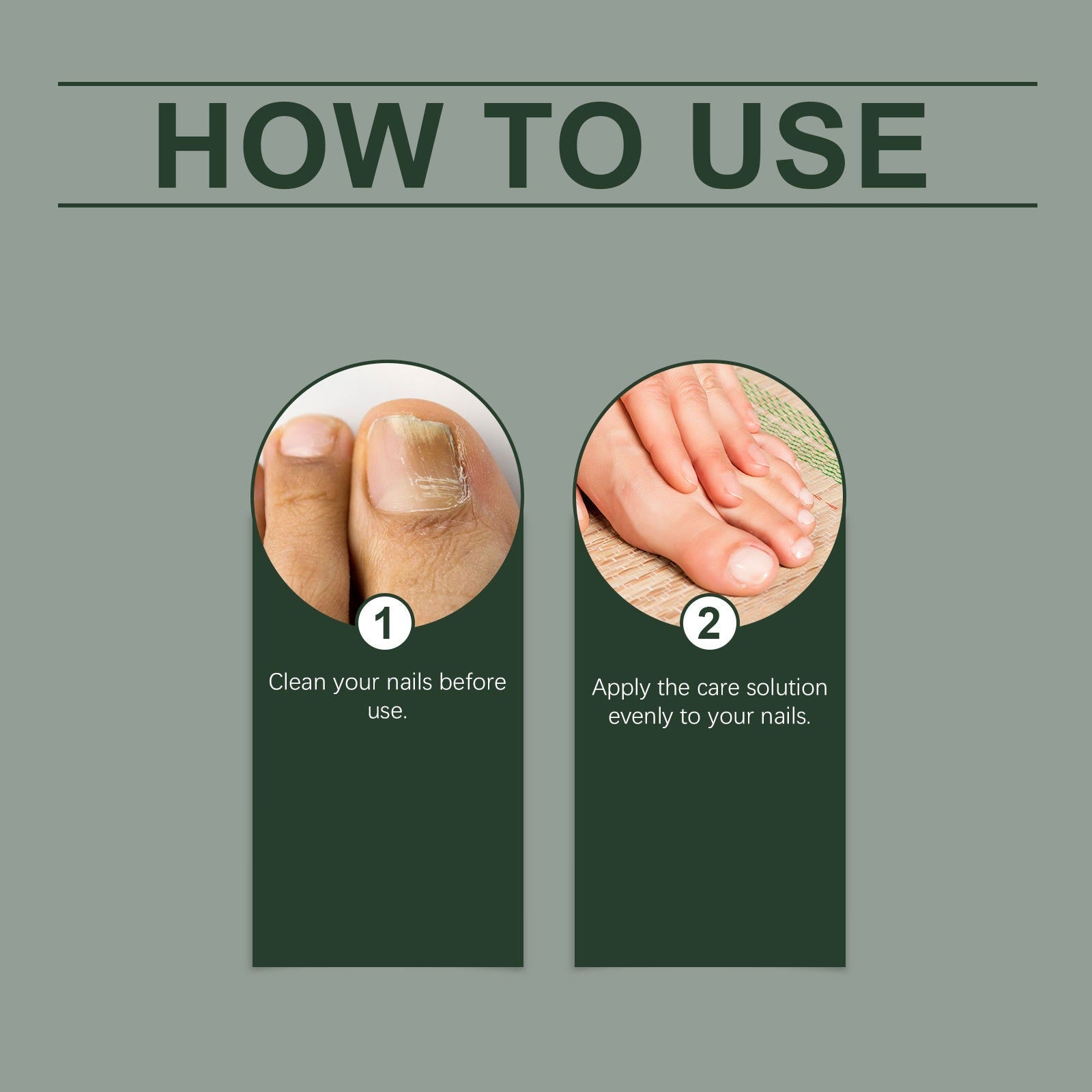 NailDrops 1+1 GRATIS: Flytande Nagelsvamp Reparation Läkning Droppar