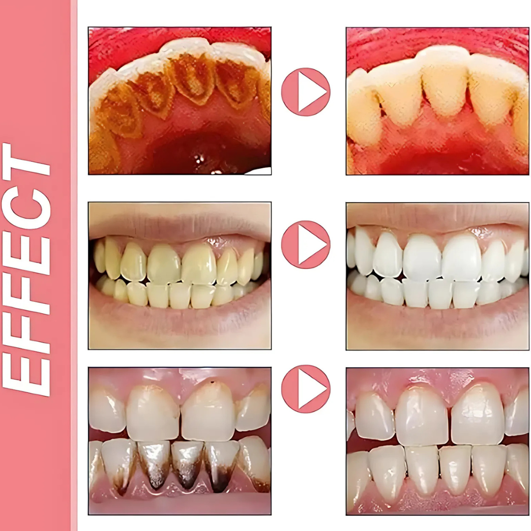 ProbioticToothpaste 1+1 GRATIS: Skonsam Vitgörande Stärkande Probiotisk Tandkräm