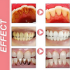 ProbioticToothpaste 1+1 GRATIS: Skonsam Vitgörande Stärkande Probiotisk Tandkräm