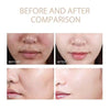 ExfoliatingSerum 1+1 GRATIS: Lättanvänd Mjuk Exfolierande Ampull För Känslig Hud